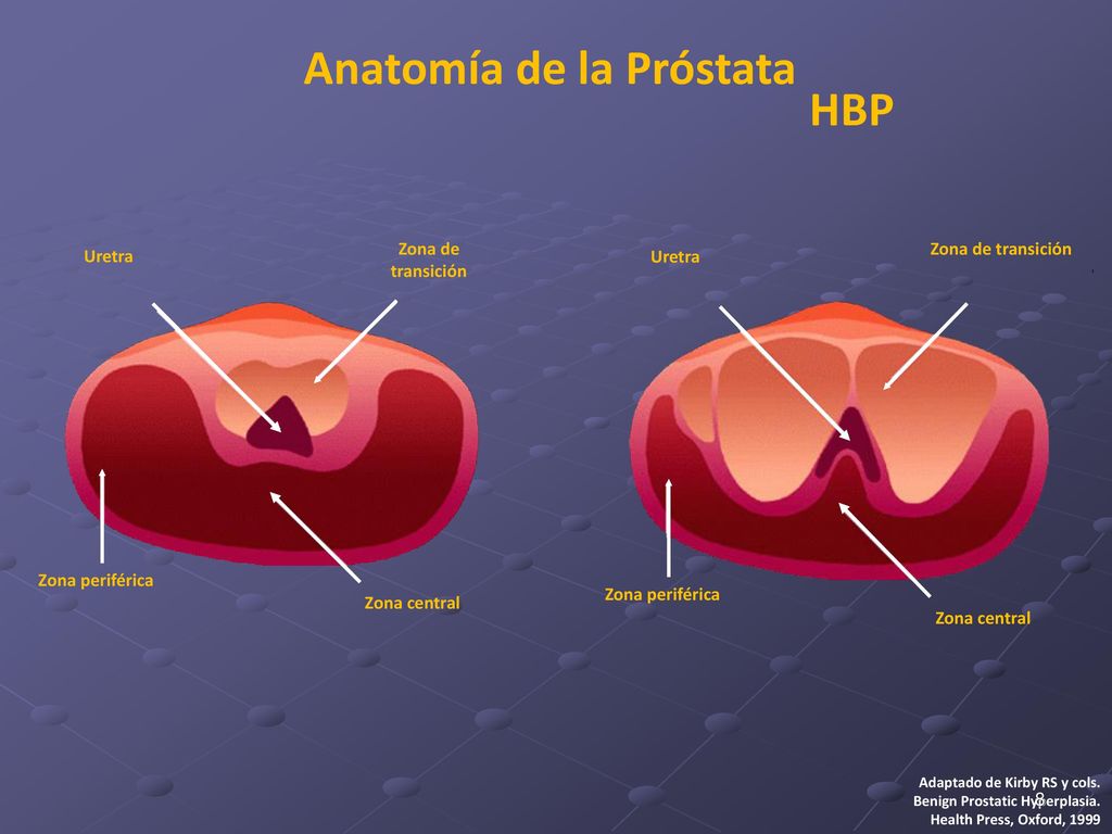 área de transición de próstata área de transición de próstata